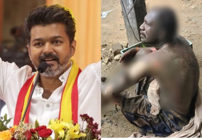 तमिलनाडु में बढ़ा सियासी तनाव: विजय के समर्थक ने लगाई खुद को आग, सरकार गठन में देरी से था नाराज
