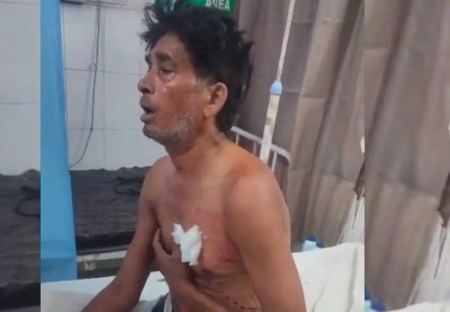 दो लाख रूपये के लिए सगे भाई पर जानलेवा हमला