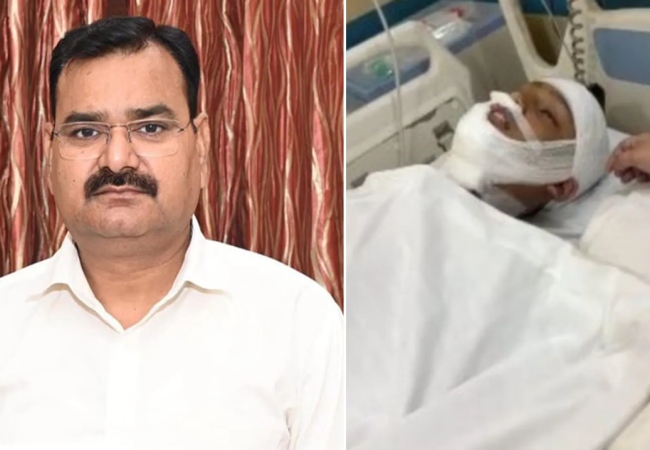 चाइनीज मांझे से कटी यूपी के मंत्री संजय गंगवार के भतीजे की गर्दन