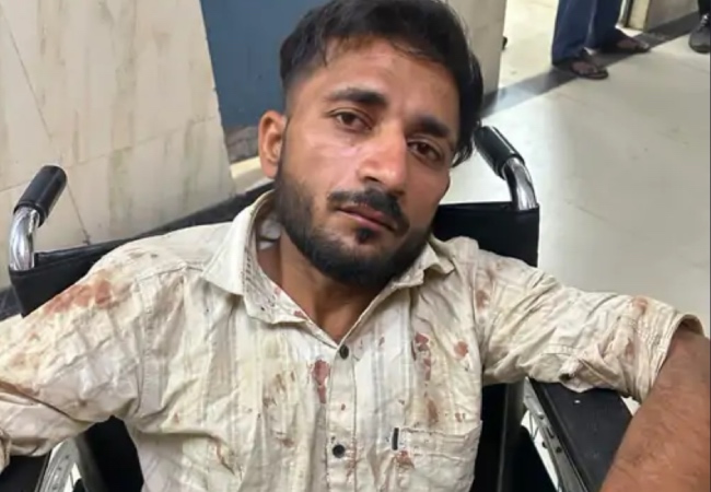 लखनऊ: यूपी पुलिस की परीक्षा देने जा रहीं लड़कियों से ऑटो चालक ने दुष्कर्म की कोशिश की, आरोपी के पैर में लगी पुलिस की गोली