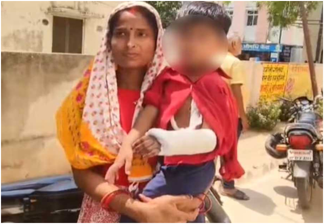 UP News : बच्ची का टूटा था दाएं हाथ, चढ़ा दिया प्लास्टर बाएं हाथ में, भगवान भरोसे सरकारी अस्पताल
