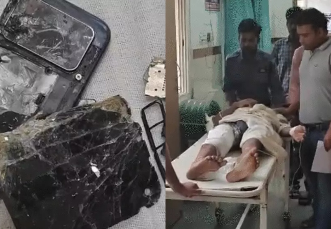 चलती बाइक पर जेब में फटा मोबाइल, प्राइवेट पार्ट झुलसा… 12 फीट तक घिसटा युवक, पैर की हड्डी भी टूटी