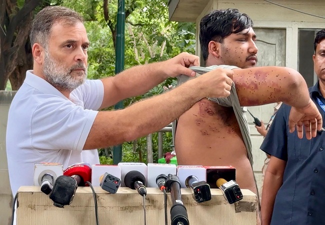 राहुल गांधी ने सरकार से दागा सवाल, बोले-छात्रों पर पैलेट गन से हमला क्यों? धर्मेंद्र प्रधान को जाना ही होगा