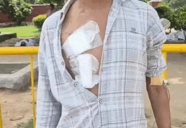 मां ने बेटे को किडनी दी, 7 लाख का ट्रांसप्लांट फेल: हर तीसरे दिन 3 डायलिसिस, मां भी बीमार, एक बीघा जमीन भी बेचनी पड़ी