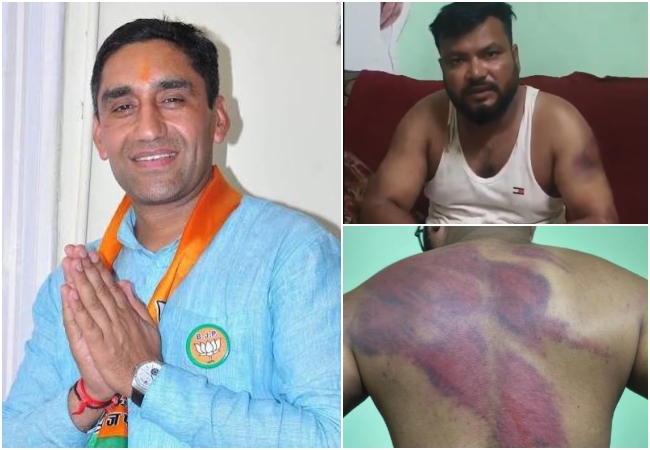 BJP विधायक ने अपनी ही पार्टी के दलित मंडल अध्यक्ष को बेरहमी से पीटा! AAP और कांग्रेस ने की SC/ST एक्ट में कानूनी कार्रवाई की मांग