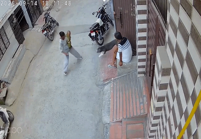 बुआ के हाथ में था 6 महीने का मासूम: दरवाजा खुलते ही ​पिटबुल ने किया हमला, बच्चे की हालत गंभीर